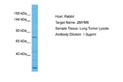 ZMYM6 Antibody, Novus Biologicals 100 &mu;L | Buy Online | Novus Biologicals | Fisher Scientific